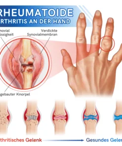 Furzero™ Neuseeland Bienengift Gelenk- und Knochentherapie Erweiterte Creme