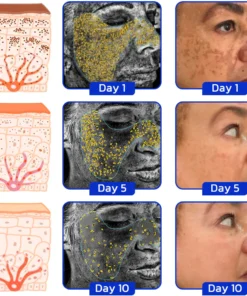 Furzero™ SpotOff Bee Venom Pigment Correction Spray