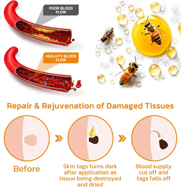 Furzero™ Tagless Bee Venom Treatment Cream