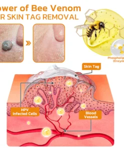 Furzero™ Tagless Bee Venom Treatment Cream