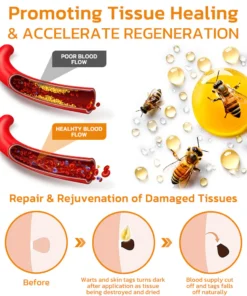 Furzero™ Tagless Bee Venom Treatment Cream