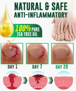 GFOUK™ FullNail Tea Tree Essential Oil