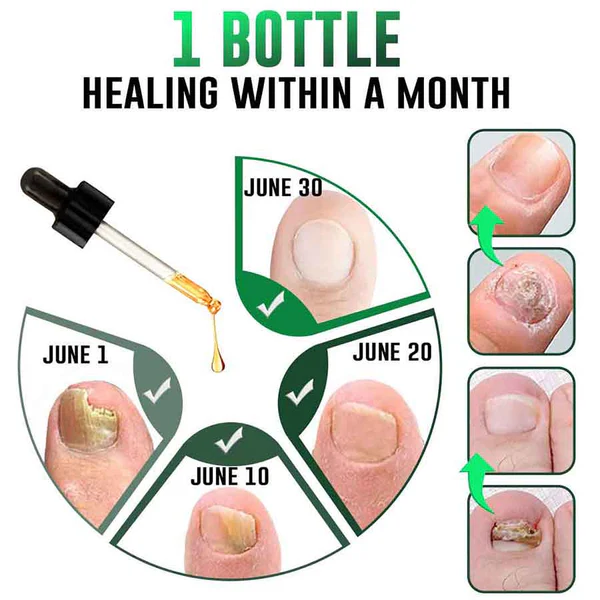 GFOUK™ FullNail Tea Tree Essential Oil