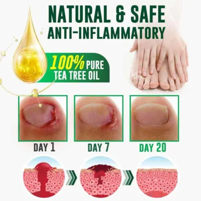 GFOUK™ FullNail Tea Tree Essential Oil