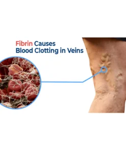 GFOUK™ VaricoX Vein Dredge Silkworm Extract Spray