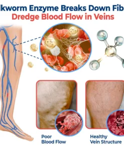 GFOUK™ VaricoX Vein Dredge Silkworm Extract Spray