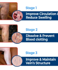 GFOUK™ VaricoX Vein Dredge Silkworm Extract Spray