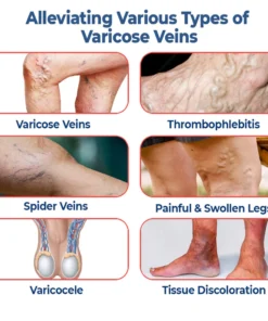 GFOUK™ VaricoX Vein Dredge Silkworm Extract Spray