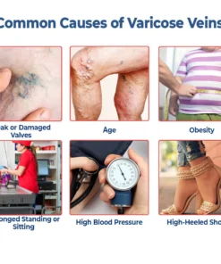 GFOUK™ VaricoX Vein Dredge Silkworm Extract Spray