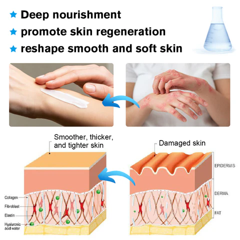 Herbal Dragon® Ringworm Removal Cream