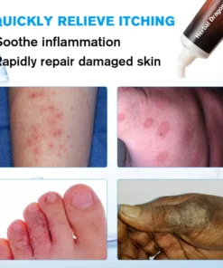 Herbal Dragon® Ringworm Removal Cream