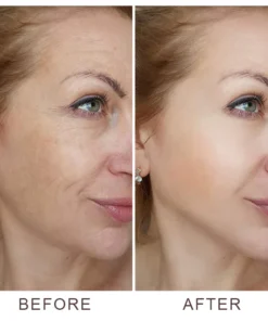 LIMETOW™ V-Shape Face-lift Firming Cream