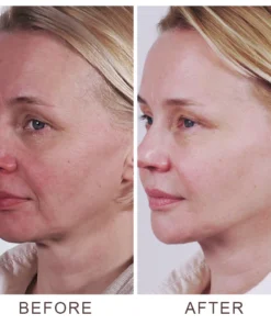 LIMETOW™ V-Shape Face-lift Firming Cream