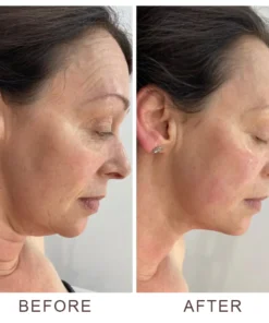 LIMETOW™ V-Shape Face-lift Firming Cream