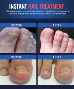 Luhaka™ ClearNail Anti-Fungal Foot Soak Powder