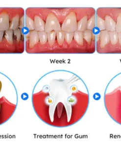 Nurbini™ Gum Therapy Gel