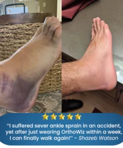 OrthoWiz™ Bone & Joint Pain Therapy Foot Brace