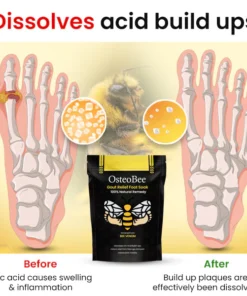 OsteoBee™ Gout Relief Foot Soak