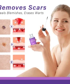 Oveallgo™ AraneaCare Flawless Hautfleckenentferner