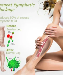 Oveallgo™ Bee Venom Soaking Beads