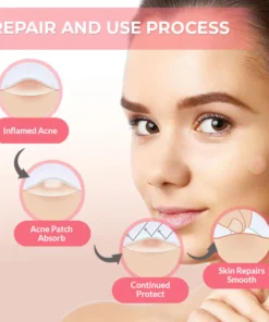 Oveallgo™ PowerClear Advanced Acne Pimple Patches