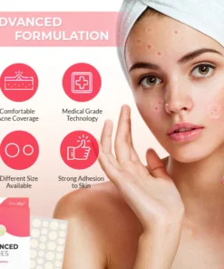 Oveallgo™ PowerClear Advanced Acne Pimple Patches