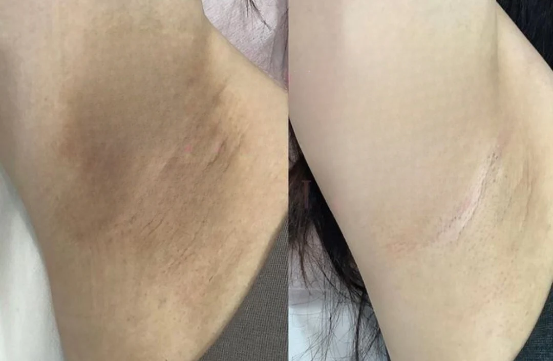 ʻO REVIGLOW™ ʻili hoʻomaʻemaʻe essence capsules