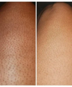 Negusy™ KeraTone Bee Venom Soap