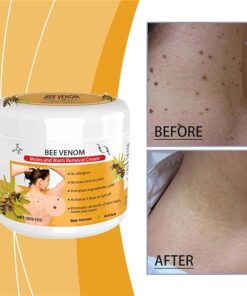Dobshow™Bee Venom Mole and Wart Treatment Cream
