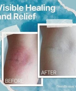 BBOJI™ The Ocean Eczema Natural Soothing Cream