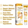 BEEVENOM VITILIGO TREATMENT CREAM