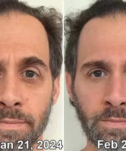 Bee Venom Depuffing Eye Serum