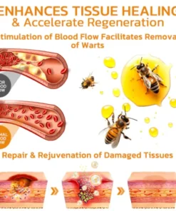 BeeGuard™ Bee Venom Mole and Wart Treatment Cream