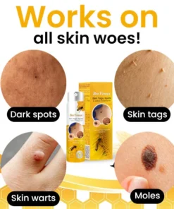 BeeVenux™ Skin Tags Spots & Mole Remover