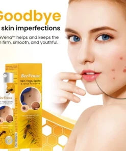 BeeVenux™ Skin Tags Spots & Mole Remover