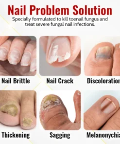 Biancat™ Japanese NailRenew Onychomycosis Swift Relief Oil