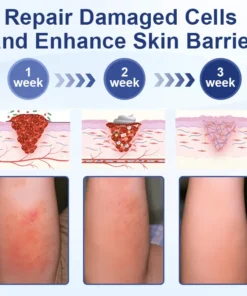 Biancat™ Ocean Aqua Soothe Eczema Relief Cream