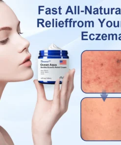 Biancat™ Ocean Aqua Soothe Eczema Relief Cream