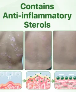 Biancat™ Psoriasis Relief Crocodile Oil Soap