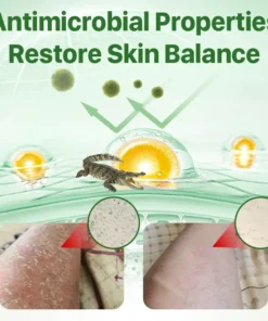 Biancat™ Psoriasis Relief Crocodile Oil Soap