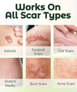 Biancat™ ScarFix Intensive Recovery Serum