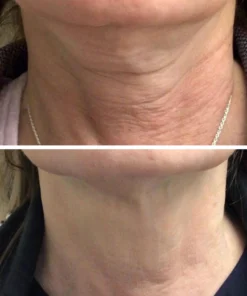 Alternative view of Biancat™ YouthGuard Ultimate Neck Lift Cream
