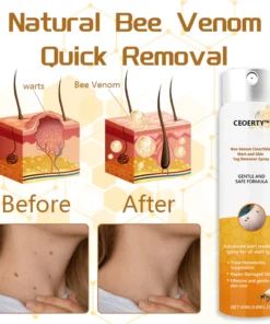 Ceoerty™ Bee Venom ClearSkin Wart and Skin Tag Remover Spray