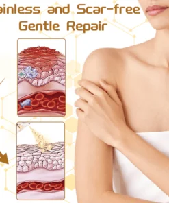 Ceoerty™ Bee Venom ClearSkin Wart and Skin Tag Remover Spray