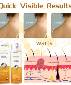Ceoerty™ Bee Venom ClearSkin Wart and Skin Tag Remover Spray