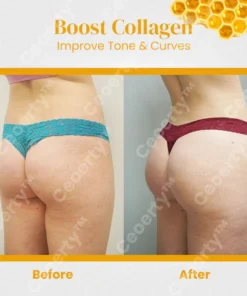 Ceoerty™ BootyBeaute Bee Venom Body Cream