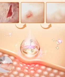 Ceoerty™ Diabetes Wound Strong Treatment Cream