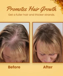 Ceoerty™ Hair Growth Bee Venom Essence Spray