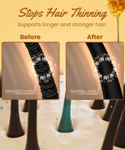 Ceoerty™ Hair Growth Bee Venom Essence Spray