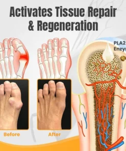 Ceoerty™ HalluxWell BeeVenom Therapy Cream